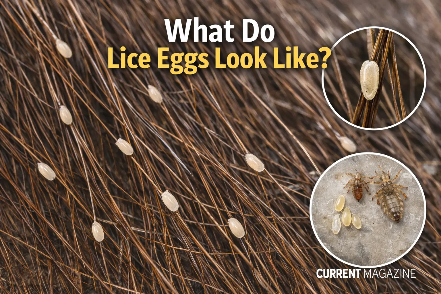 What Do Lice Eggs Look Like
